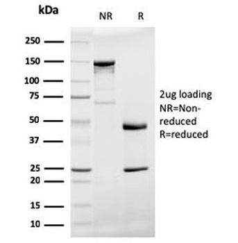 Prohibitin Antibody / PHB