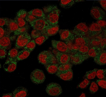 PHB Antibody / Prohibitin