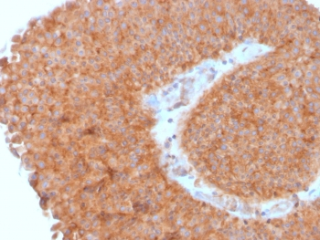SERBP1 Antibody / PAI-RBP1
