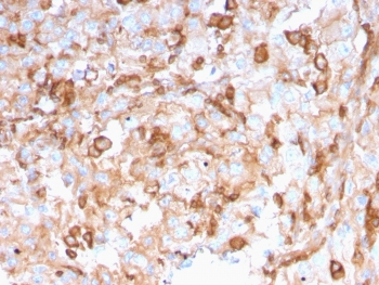 SERBP1 Antibody / PAI-RBP1
