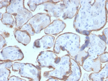 PAPP-A Antibody / Pappalysin-1