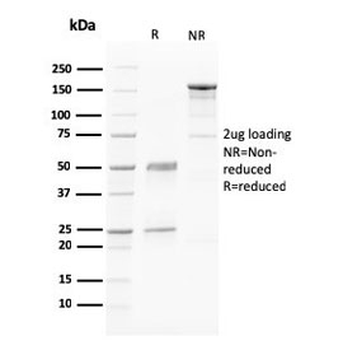 PAPP-A Antibody / Pappalysin-1