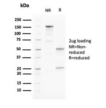 PAPP-A Antibody / Pappalysin-1