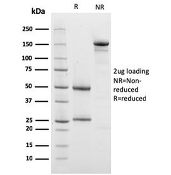 PHB Antibody / Prohibitin