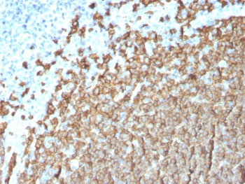 CD20 Antibody
