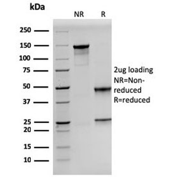 Prolactin Antibody / PRL