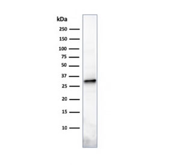 Prolactin Antibody / PRL