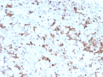 Prolactin Antibody / PRL