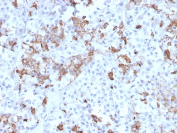 Prolactin Antibody / PRL