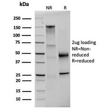 Prolactin Antibody / PRL