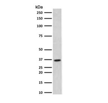 Thymidylate Synthase Antibody