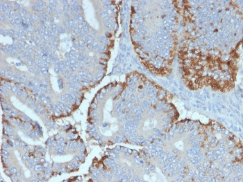 ATG5 Antibody