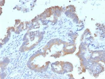 ATG5 Antibody