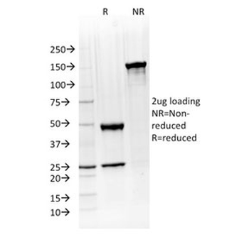 ATG5 Antibody