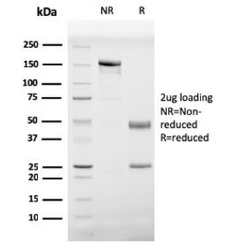 PHB Antibody / Prohibitin