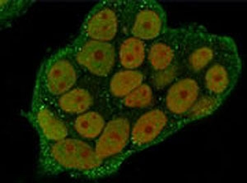 ANXA1 Antibody / Annexin A1