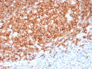 CD20 Antibody