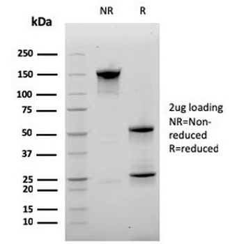 CD20 Antibody