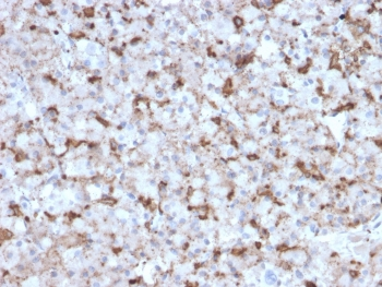 Prolactin Antibody / PRL