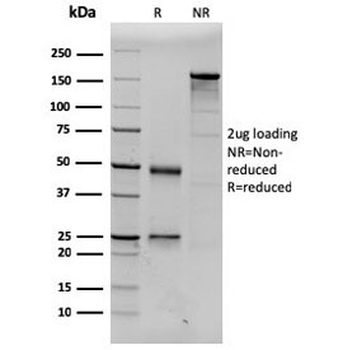 Prolactin Antibody / PRL