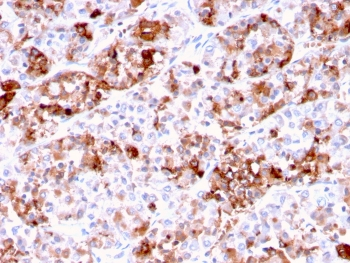 Prolactin Antibody / PRL
