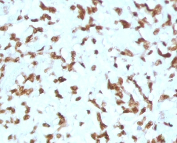 Cathepsin D Antibody / CTSD