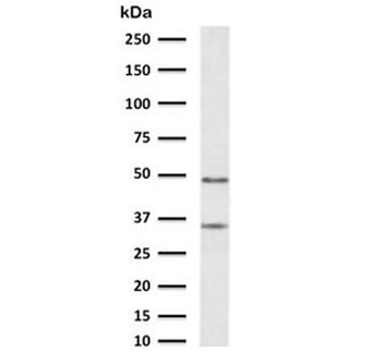 Cathepsin D Antibody / CTSD