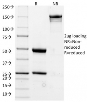 CD20 Antibody