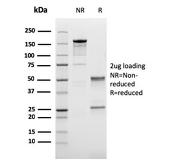 Cadherin 17 Antibody
