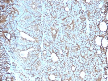 Cadherin 17 Antibody