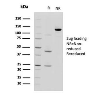 Cadherin 17 Antibody