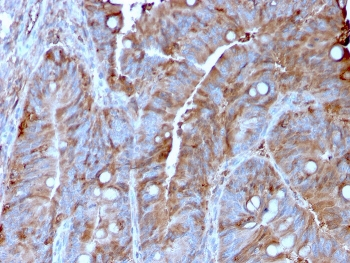 MerTK Antibody