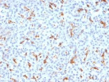 CFTR Antibody / Cystic Fibrosis Transmembrane Regulator
