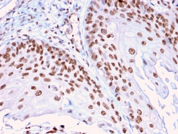 DMC1 Antibody