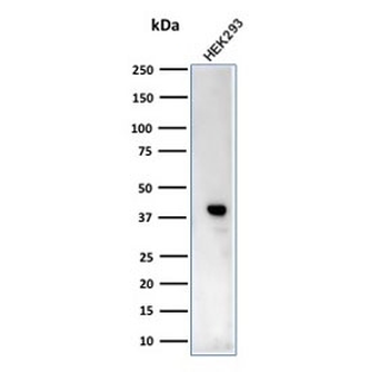 CKB Antibody / Creatine Phosphokinase-BB