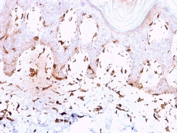Collagen VII antibody / COL7A1