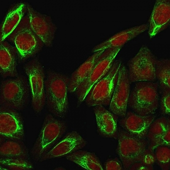 Collagen VII antibody / COL7A1