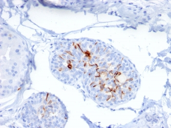 ZNF690 Antibody / ZSCAN29