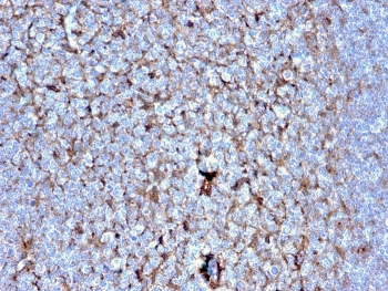 Cystatin A Antibody / CSTA