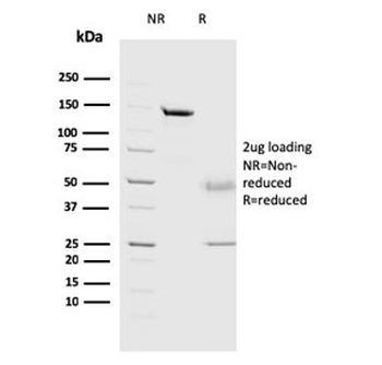 CTSD Antibody / Cathepsin D