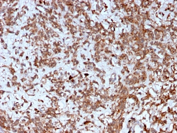 Cathepsin K Antibody / CTSK