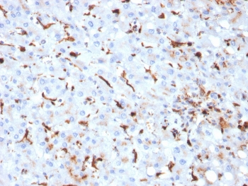 Cathepsin K Antibody / CTSK