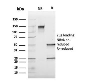 Cathepsin K Antibody / CTSK