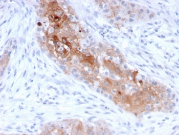 Desmoglein 1 Antibody / DSG1