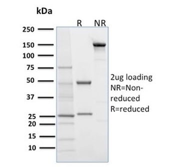 Desmoglein 1 Antibody / DSG1