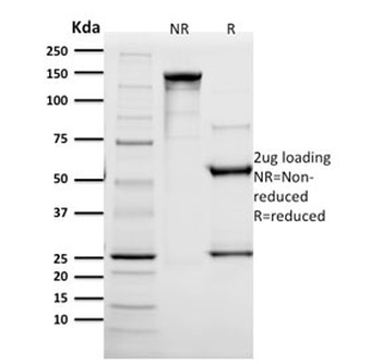 HER2 Antibody / ErbB2