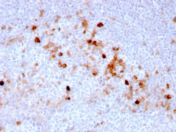 CD105 Antibody / Endoglin