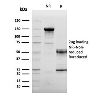 CD105 Antibody / Endoglin