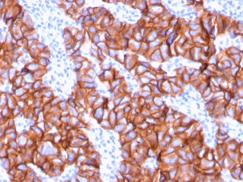HER2 Antibody / ErbB2