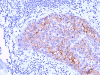 HER2 Antibody / ErbB2